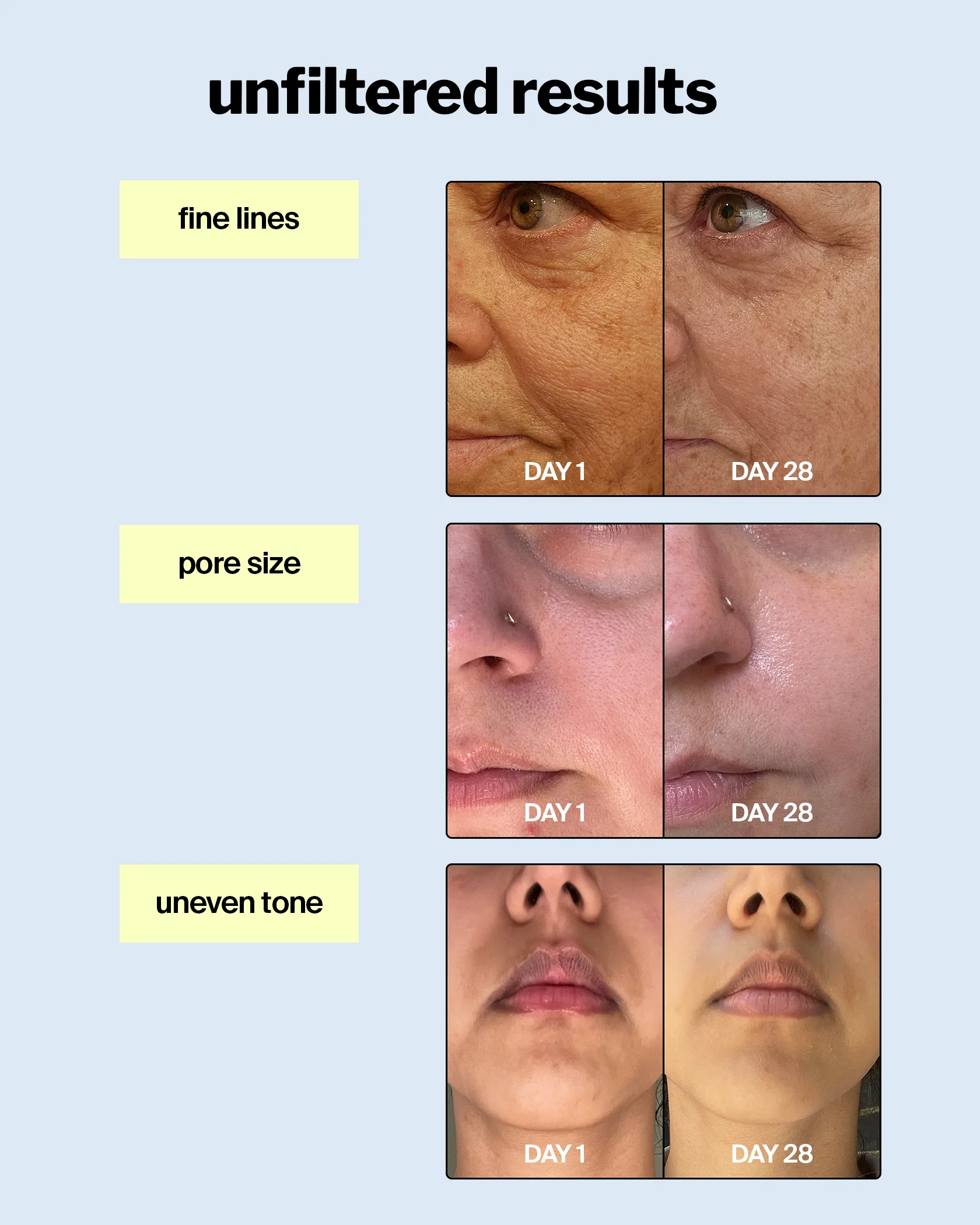 advanced retinol gel 0.5% - Image 3