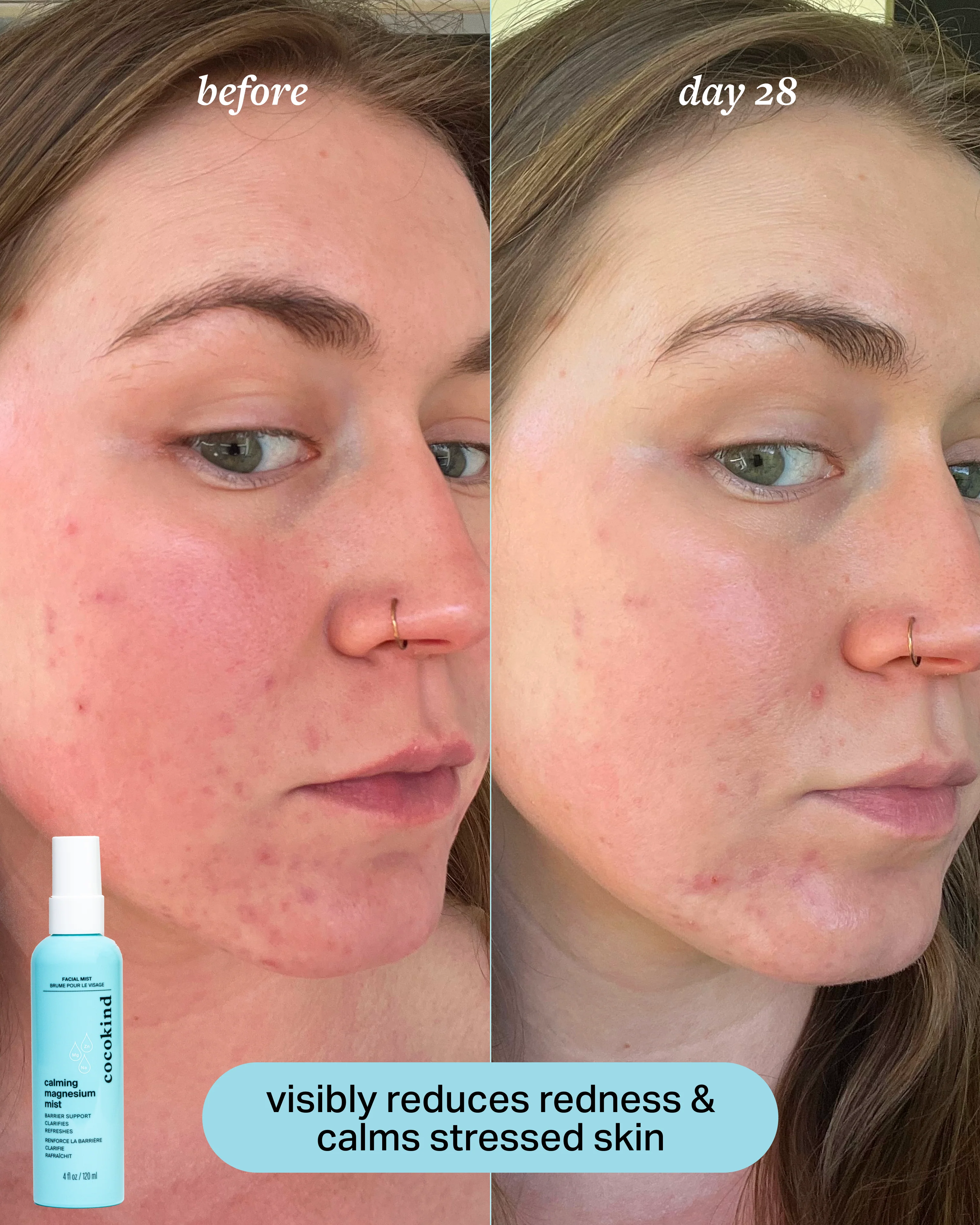 calm & clarify duo - Image 5