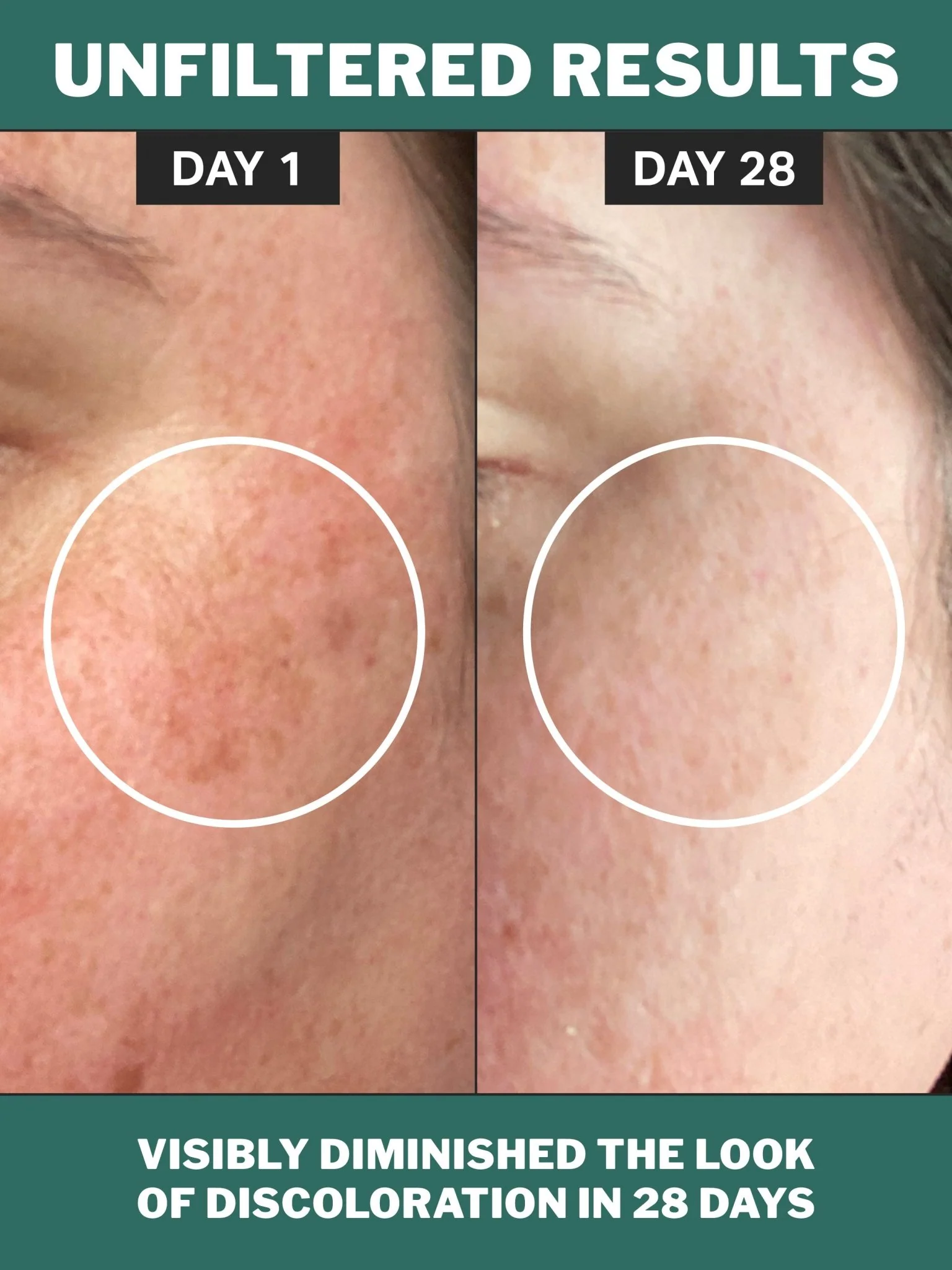 chlorophyll discoloration serum - Image 3