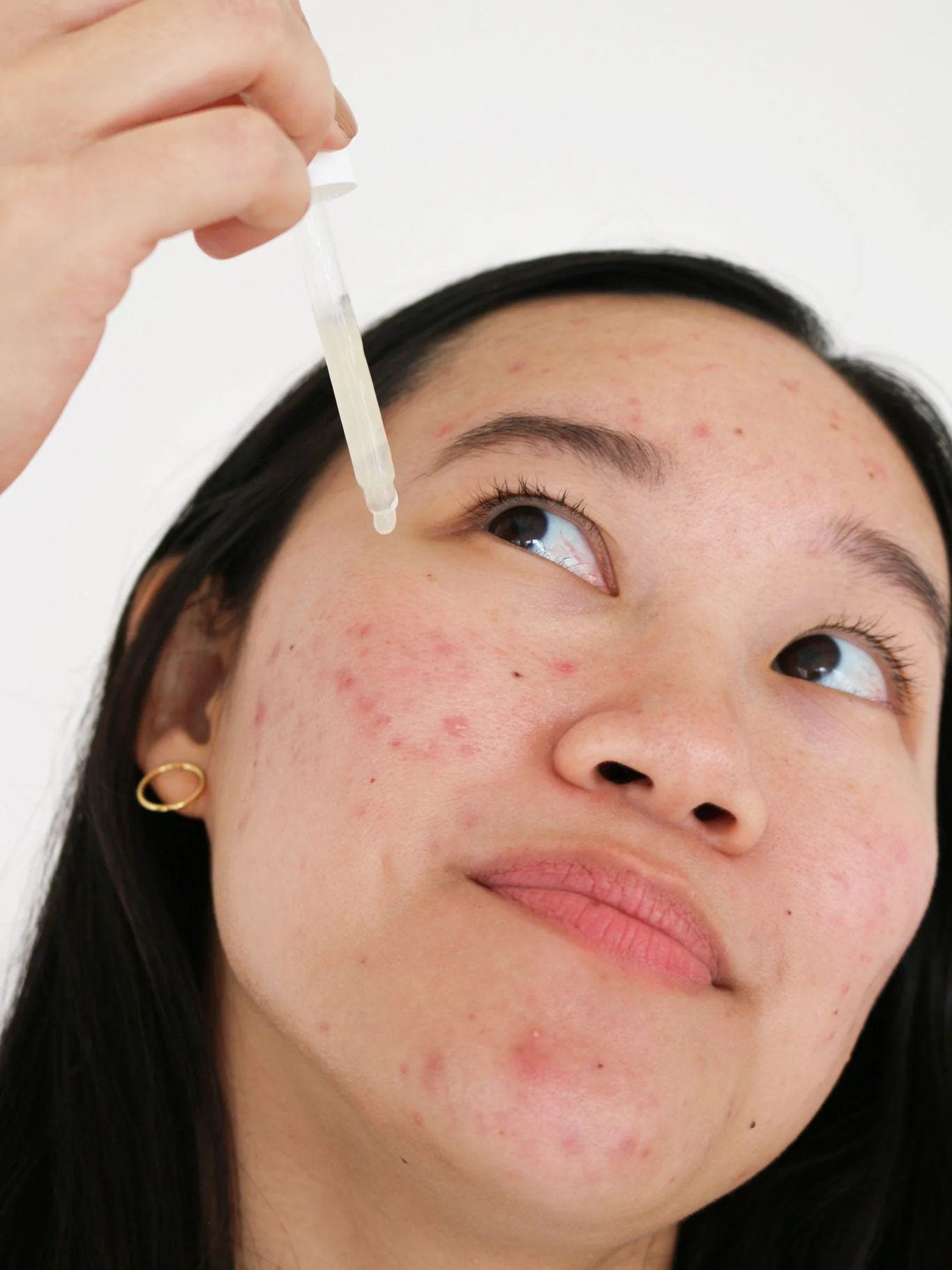 postbiotic acne serum - Image 3