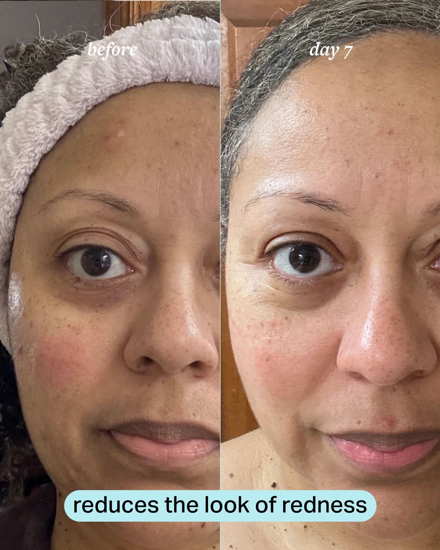 calming magnesium mist - Image 5