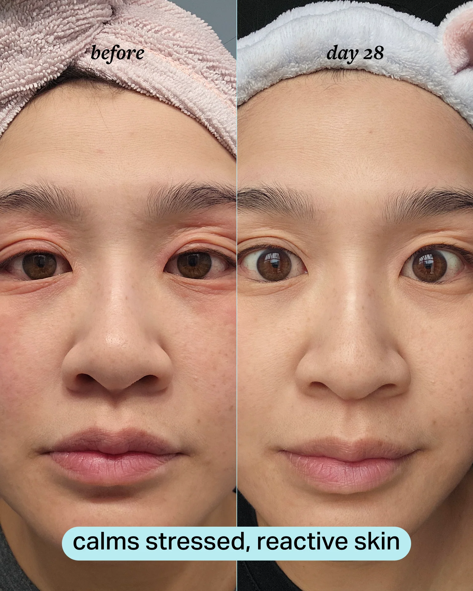 calming magnesium mist - Image 6